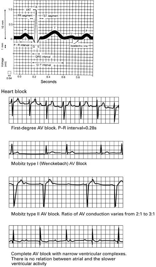 NOMENCLATURE ECG