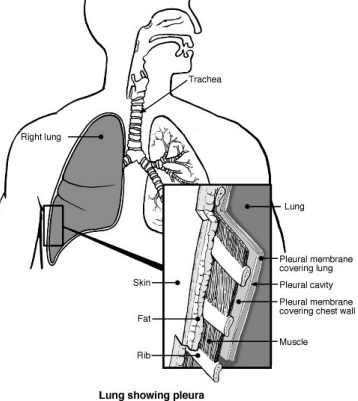 Poumons et voies respiratoires avec plèvre
