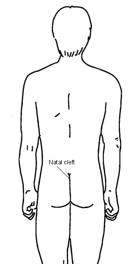 Schéma de la fente natale