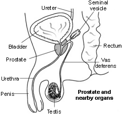 Schéma en coupe de la prostate et des organes voisins