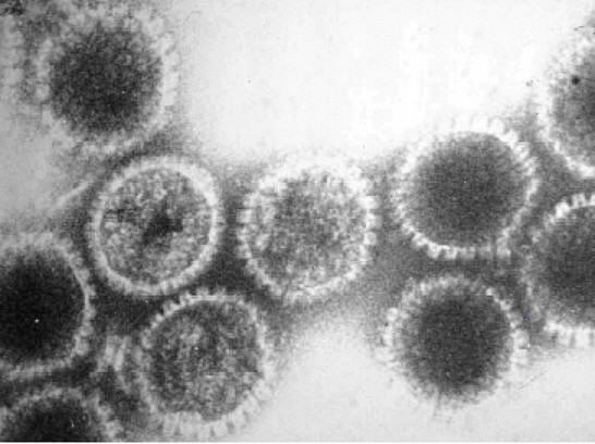 Herpèsvirus humain