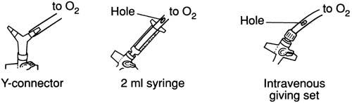 CRICOTHYROÏDOTOMIE (2)