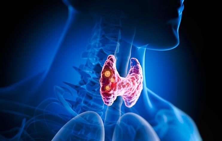 Thyroïde sous-active