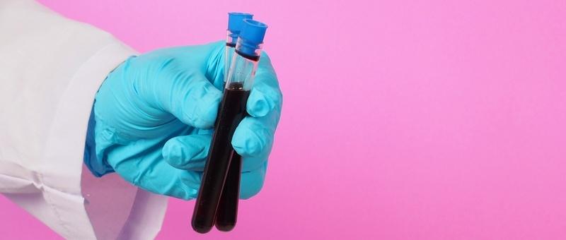 Main gantée de chirurgien tenant des tubes à essai remplis de sang sur un fond violet