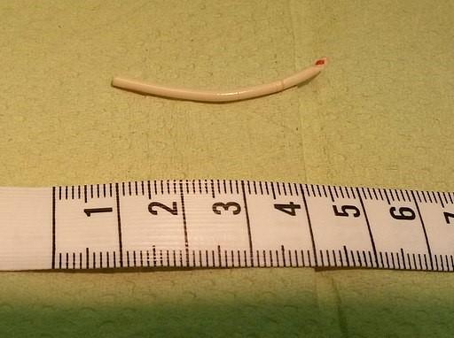 Implant contraceptif Implanon