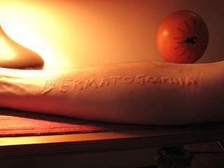 Urticaire dermatographique