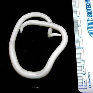 Ascaris lumbricoides (ver rond)