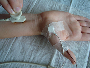 Vitesse de conduction nerveuse