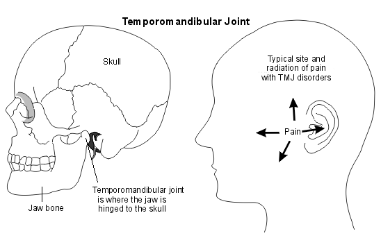 Dysfonctionnement de l'articulation temporo-mandibulaire
