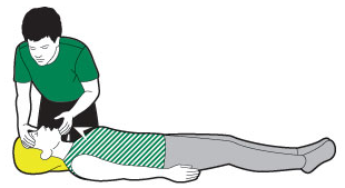 Ouvrir les voies respiratoires adulte