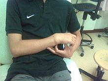 Fracture de la colonne vertébrale à l'extérieur. Pas de radiographie