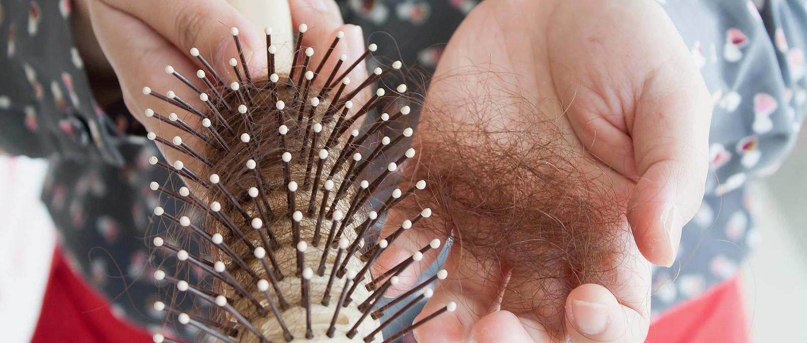Female hair loss (cropped)