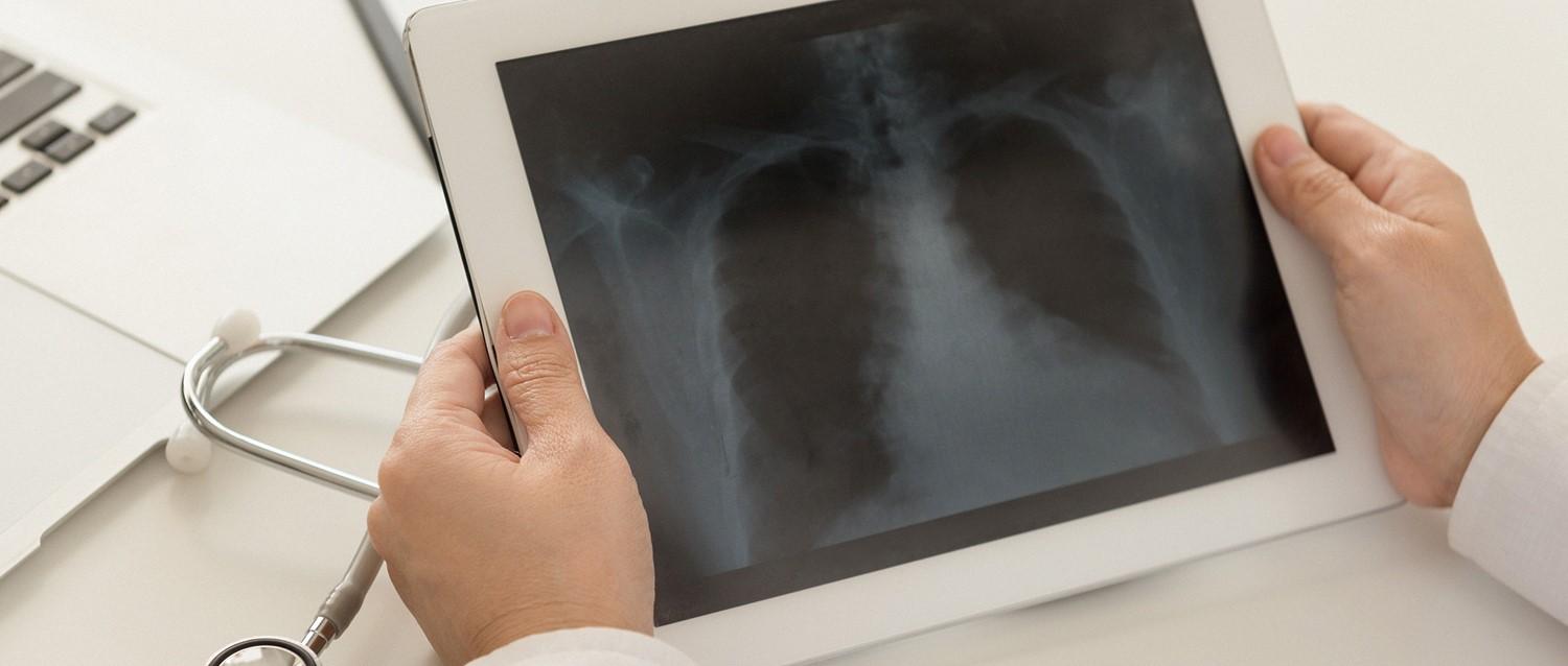 Image de l'article en vedette