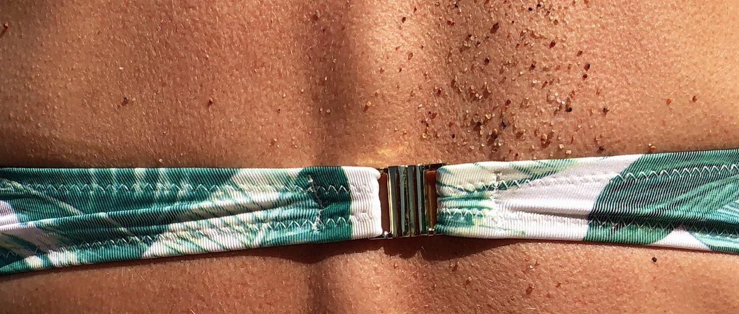 Soleil et coups de soleil