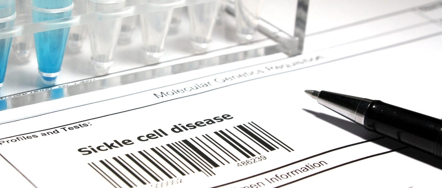 what does the new treatment for sickle cell disease mean for sickle cell patients