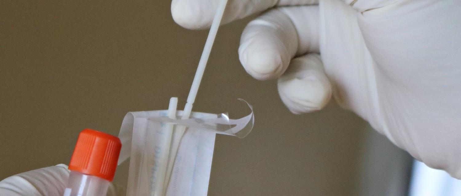 COVID-19 : Quand faut-il faire un test de débit latéral et quand faut-il faire un PCR ?