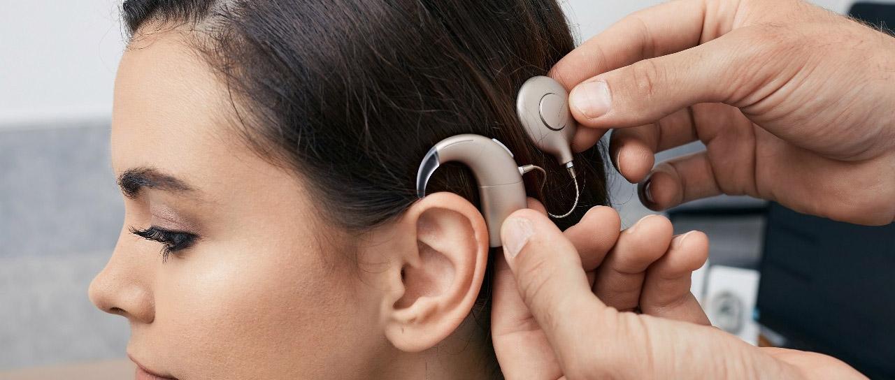 Qu'est-ce qu'un implant cochléaire et quel est son effet sur l'audition ?