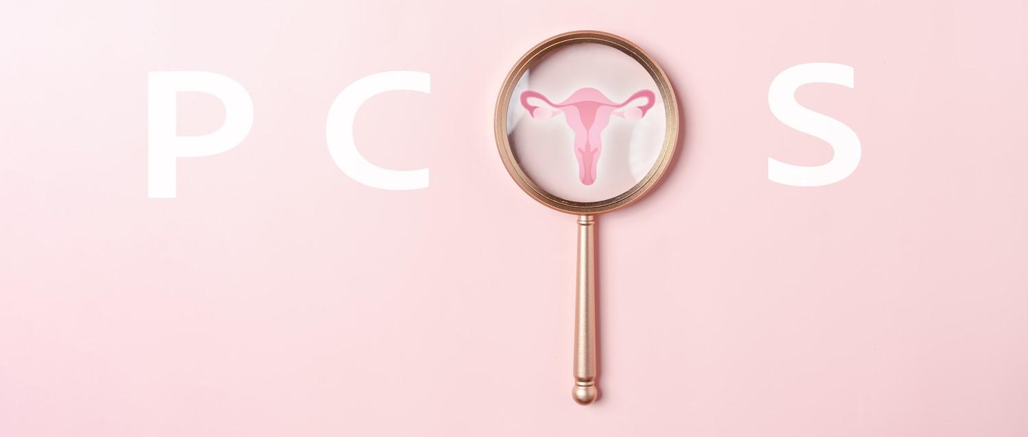 Image de l'article en vedette